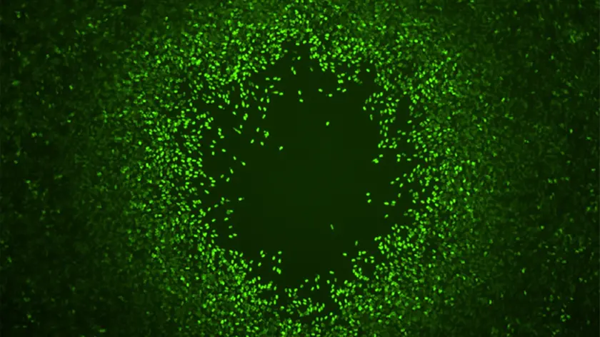 Delle spore batteriche fotografate con il microscopio