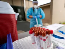 Test kits sit on a table as healthcare professional Kenzie Anderson prepares to take a sample at a United Memorial Medical Center COVID-19 testing site Friday, June 26, 2020, in Houston. The number of COVID-19 cases continues to rise across the state. Texas Gov. Greg Abbott has said that the state is facing a \"massive outbreak\" in the coronavirus pandemic and that some new local restrictions may be needed to protect hospital space for new patients. (AP Photo/David J. Phillip)