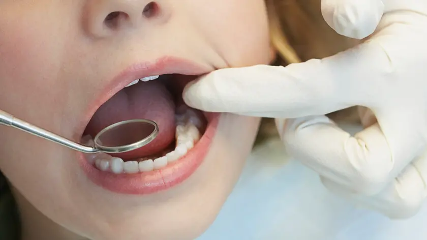 Una bambina dal dentista