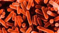 Il batterio della legionella pneumophila visto al microscopio