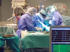 Un'equipe medica impegnata in sala operatoria in un trapianto di organi