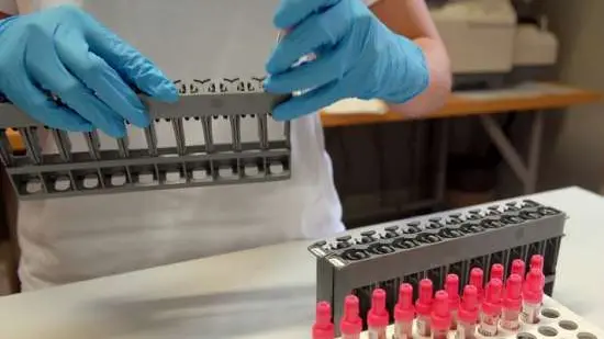 Provette per le analisi di laboratorio in una foto di archivio