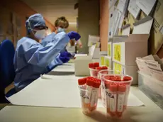 Personale sanitario del laboratorio di microbiologia dellÂ?ospedale di Cremona effettuano prelievi ematici per i test sierologici per verificare la presenza degli anticorpi per lÂ?emergenza epidemia coronavirus Covid-19. ANSA/MATTEO CORNER
