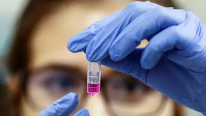 epa08303750 Brazilian scientist in the Immunology laboratory of the Heart Institute (Incor) of the Faculty of Medicine of the University of Sao Paulo, in Sao Paulo, Brazil, 17 March 2020 (issued 18 March 2020). Brazilian scientists develop a coronavirus vaccine with a different method than those used so far by the pharmaceutical industry and groups of researchers from other countries, who expect it to be tested on animals in the coming months. It is the current great challenge of the international scientific community and Brazil, as a power in Latin America, has joined this agonizing race to discover an effective immune response against the virus that has paralyzed half the world, although it has done so with a different approach. Meanwhile, Brazilians remain skeptical about the extent of this global pandemic in the country, where there are about 300 confirmed cases and at least one death from COVID-19. EPA/Sebastiao Moreira