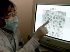 Il coronavirus indicato sul monitor