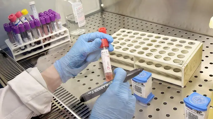 epa08179704 A laboratory assistant prepares a test for the Coronavirus at the Amedeo di Savoia hospital in Turin, Italy, 30 January 2020. The coronavirus, called 2019-nCoV, originating from Wuhan, China, has spread to all the 31 provinces of China as well as more than a dozen countries in the world. EPA/ALESSANDRO DI MARCO