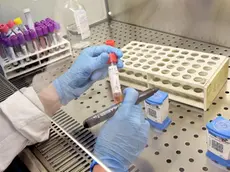 epa08179704 A laboratory assistant prepares a test for the Coronavirus at the Amedeo di Savoia hospital in Turin, Italy, 30 January 2020. The coronavirus, called 2019-nCoV, originating from Wuhan, China, has spread to all the 31 provinces of China as well as more than a dozen countries in the world. EPA/ALESSANDRO DI MARCO