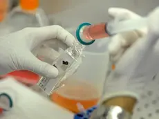 Un medico del laboratorio 'Genoma' di Roma durante lo studio del Dna per l'identificazione dell'eventuale presenza di malattie genetiche o di alterazioni cromosomiche, 28 agosto 2012. La Corte europea dei diritti umani ha bocciato la legge 40 per quanto riguarda l'impossibilita' per una coppia fertile ma portatrice sana di fibrosi cistica di accedere alla diagnosi preimpianto degli embrioni. ANSA/ETTORE FERRARI