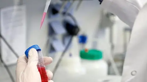 epa08473172 A laboratory employee works in a Laboratory at the Institute of Virology at the University in Marburg, Germany, 08 June 2020. The Philipps University of Marburg, the German Centre for Infection Research (DZIF), the Ludwig Maximilian University of Munich (LMU) and the University Medical Centre Hamburg-Eppendorf (UKE) are jointly researching a vaccine against the SARS-CoV-2 coronavirus. Countries around the world are taking increased measures to stem the widespread of the SARS-CoV-2 coronavirus which causes the Covid-19 disease. EPA/RONALD WITTEK