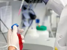 epa08473172 A laboratory employee works in a Laboratory at the Institute of Virology at the University in Marburg, Germany, 08 June 2020. The Philipps University of Marburg, the German Centre for Infection Research (DZIF), the Ludwig Maximilian University of Munich (LMU) and the University Medical Centre Hamburg-Eppendorf (UKE) are jointly researching a vaccine against the SARS-CoV-2 coronavirus. Countries around the world are taking increased measures to stem the widespread of the SARS-CoV-2 coronavirus which causes the Covid-19 disease. EPA/RONALD WITTEK